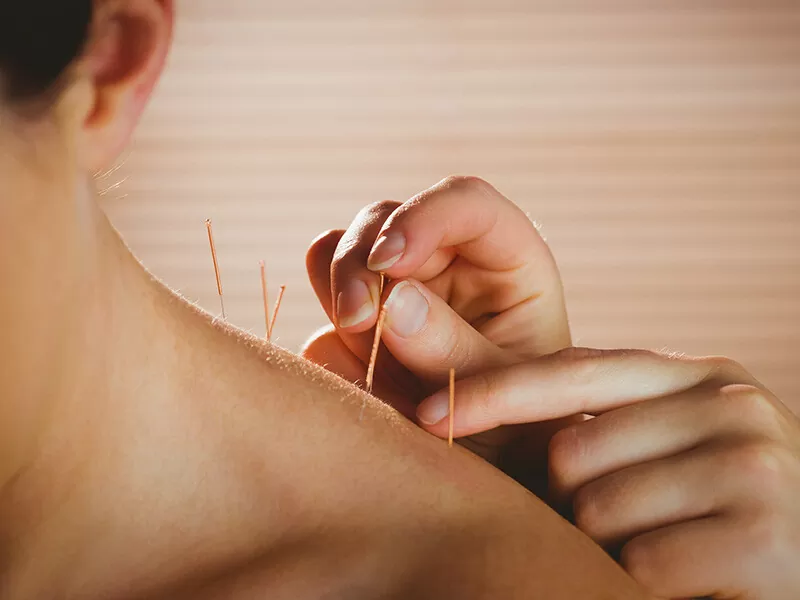 Akupunktur bei Faszienverklebung